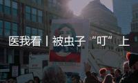 医我看丨被虫子“叮”上 ，发现“高烧和焦痂”？别大意	
，这样急救！