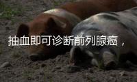 抽血即可诊断前列腺癌，拜登为何不测
？