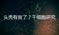 头秃有救了	？干细胞研究阐明压力如何影响毛发生长