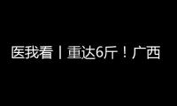医我看丨重达6斤！广西女子乳腺肿瘤2年疯长至篮球大�
，医生提醒：这些情况务必重视